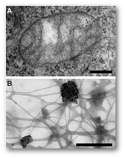 Electron microscopy: (A) Gold particles  mark DNA near the mitochondria. (B) DNA is marked with gold particles after extraction.  Source