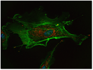 If this endothelial cell were in the body, potassium would be inside it, where various structures are stained blue and red. Sodium would be outside the cell, where the green filaments are in this picture.